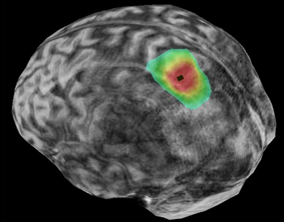 020618_dg_brain-rhythm_main-e1552320190621.jpg